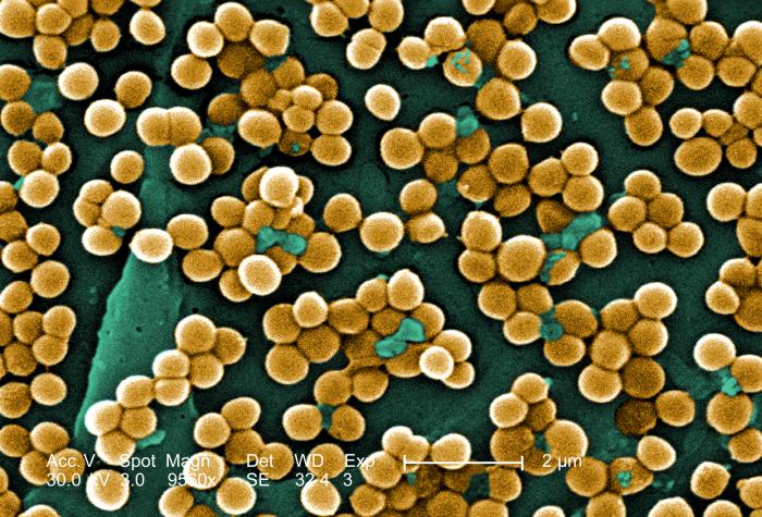 Just_staphylococcus_aureus.jpg